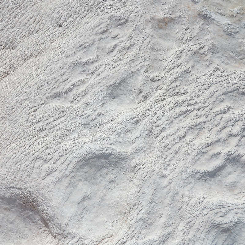 calcified shoulder