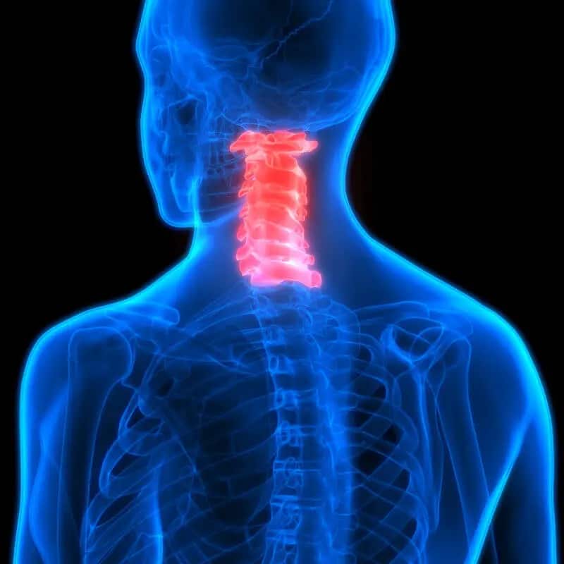 back pain - cervical spine