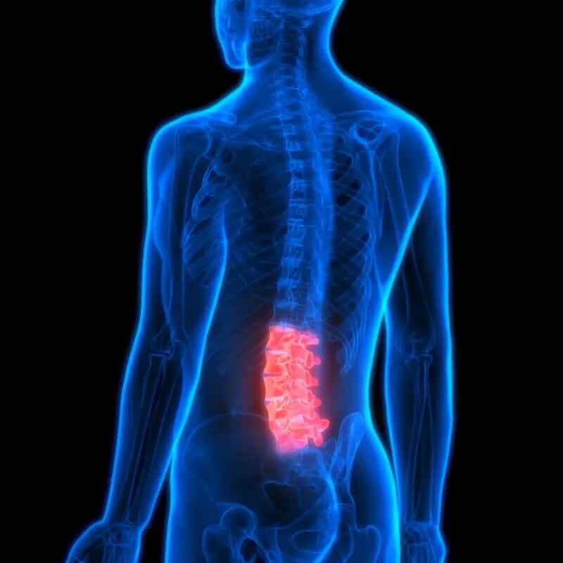 back pain-lumbar spine column