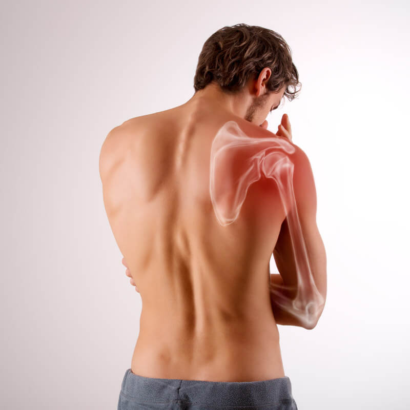 Artistic depiction of a man's shoulder pain.
