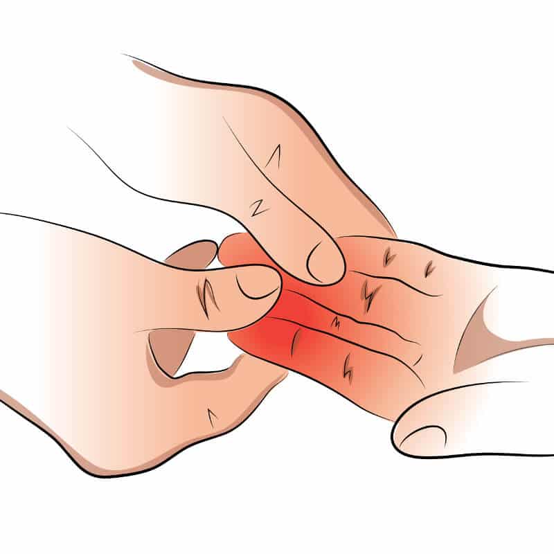 Illustration of tingling hands.