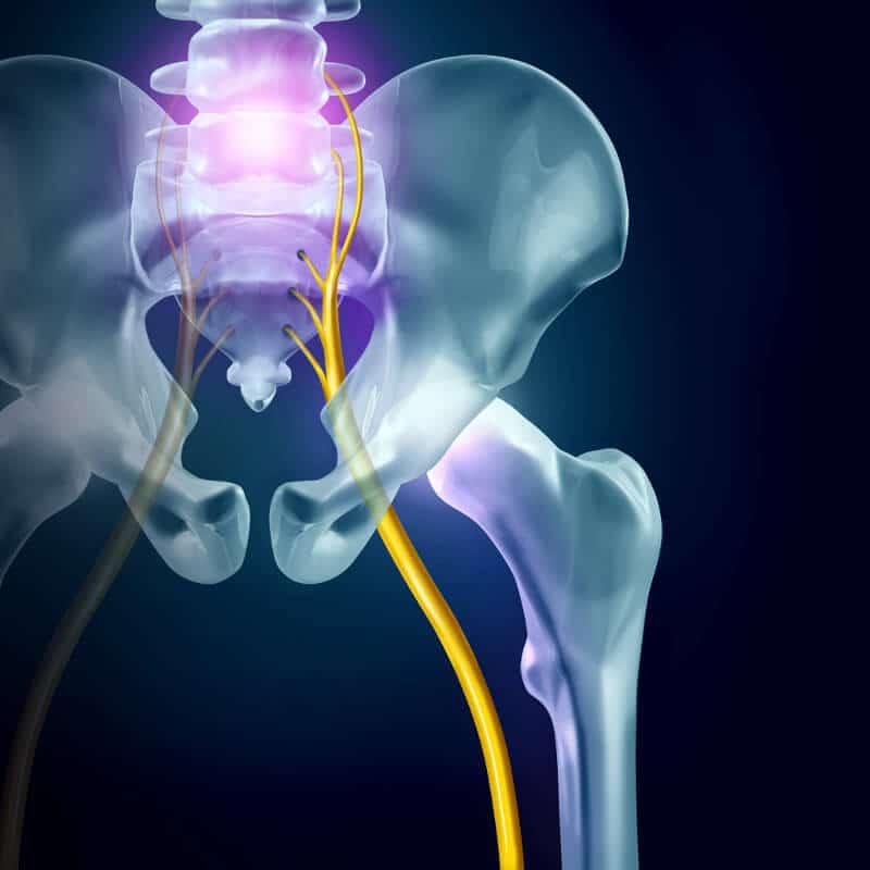 Illustration of the sciatic nerve.