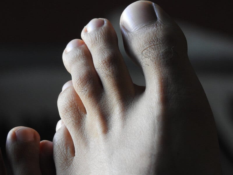 A picture of a foot.