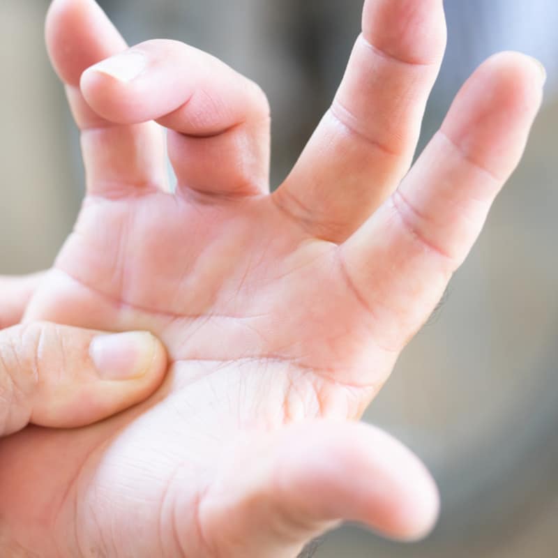 A hand with trigger finger.