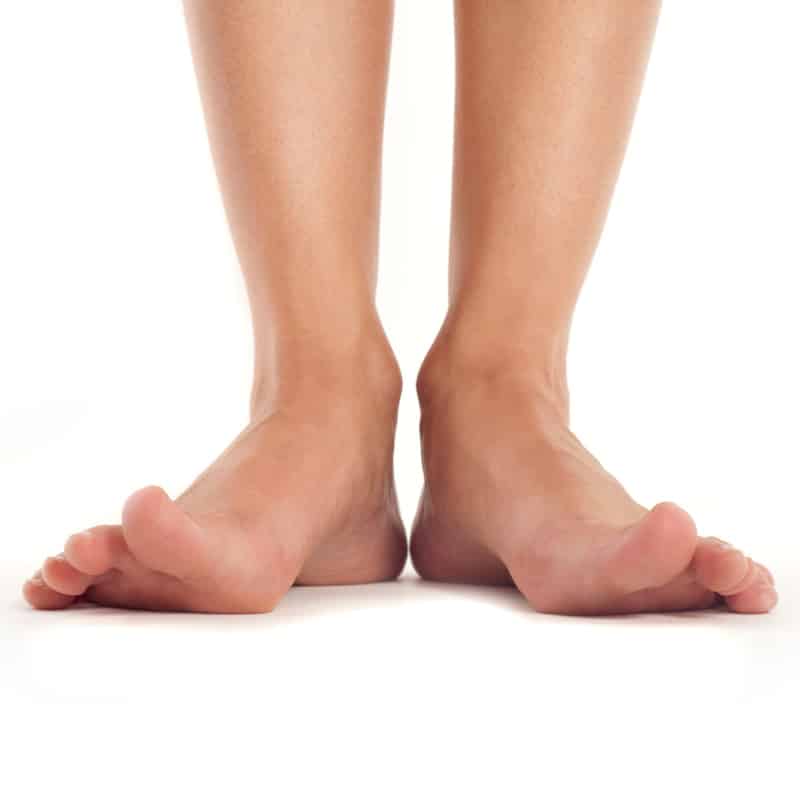 Closeup of splayed feet.